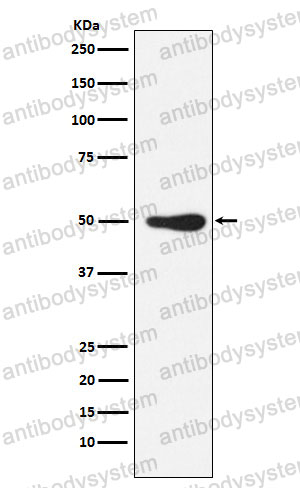 Anti-FOXL2 Antibody (R1Z65)