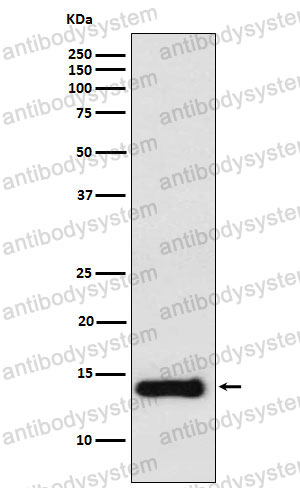 Anti-PROK1/EG-VEGF Antibody (R1Z66)