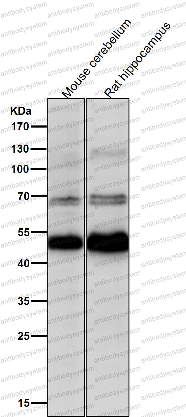 Anti-VSX2 Antibody (R1Z67)