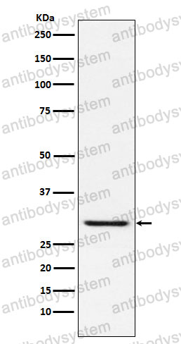 Anti-TIRAP Antibody (R1Z68)
