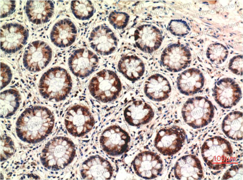 Anti-PTEN Antibody (R3N78)