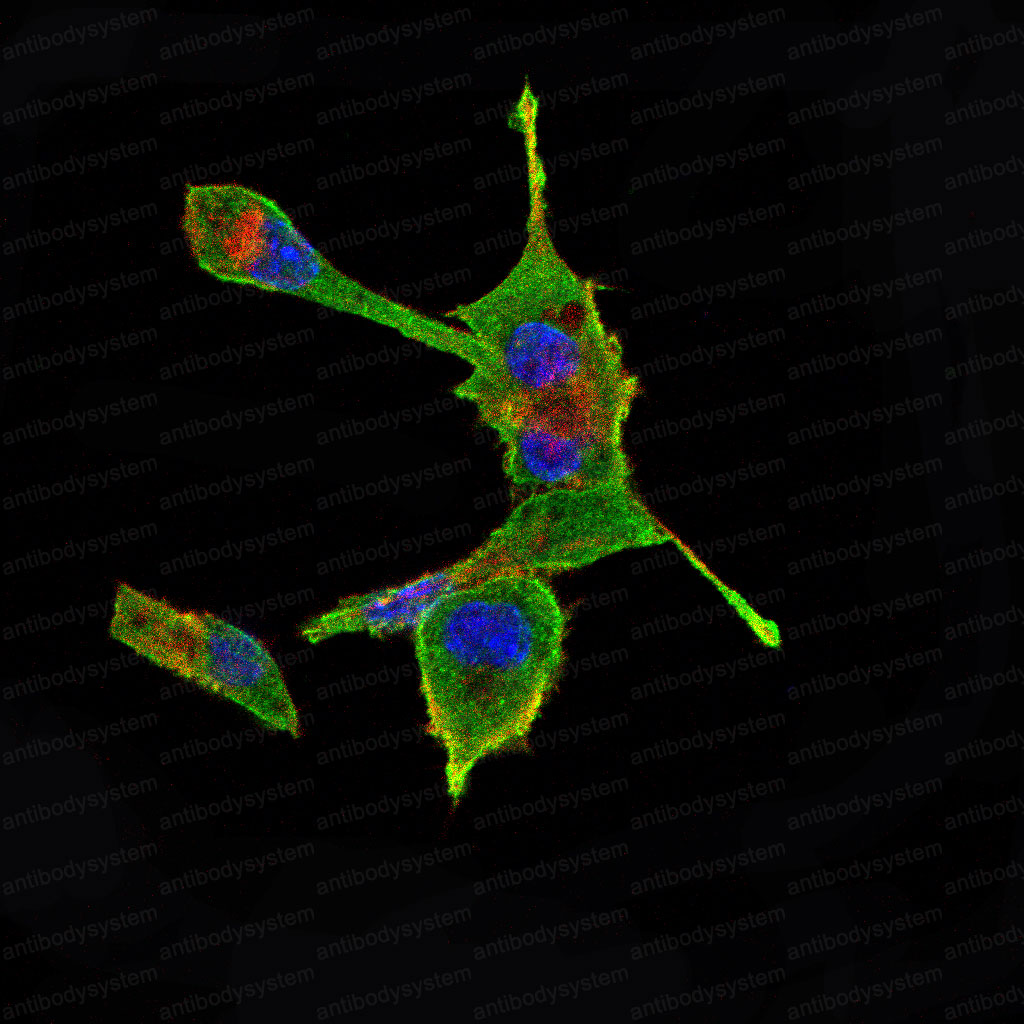 Anti-IL2 Antibody (R3N79)