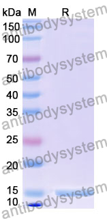 Anti-Human ACTB/β-actin/Beta Actin Nanobody (SAA1234)