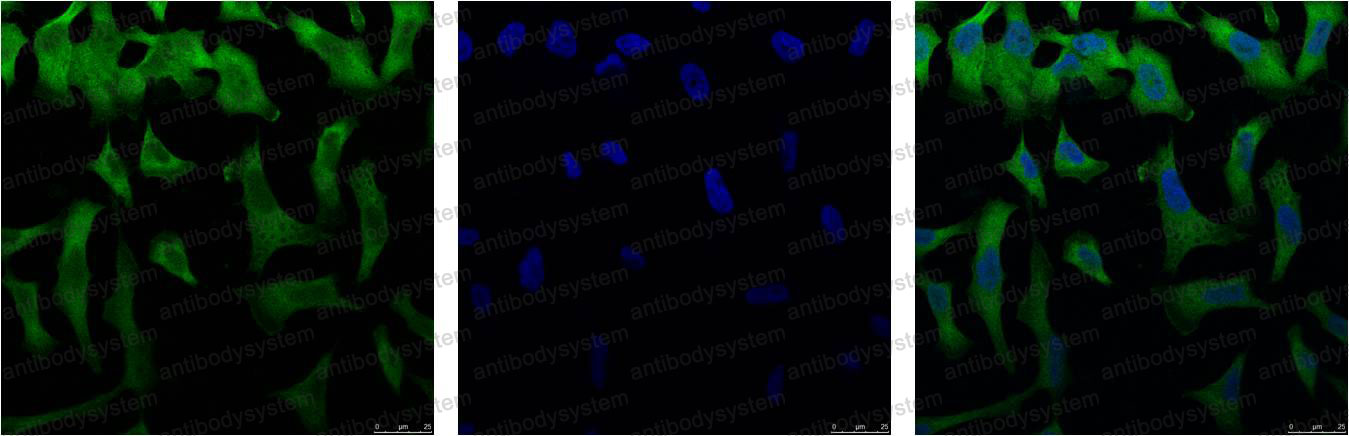 Anti-EIF4A1 Antibody (R3N81)