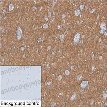 Anti-SNAP25 Antibody (R3N82)