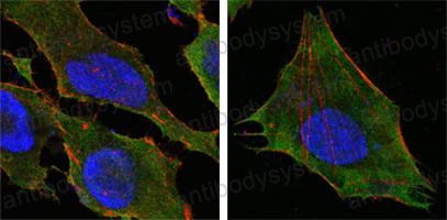 Anti-S100A10 Antibody (R3N83)