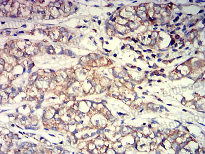 Anti-ACTR3 Antibody (R3N88)