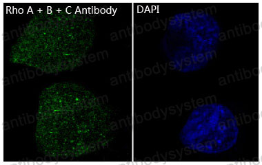 Anti-RhoA+B+C Antibody (R1C20)