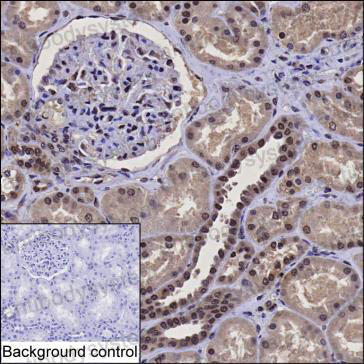 Anti-HNRNPK Antibody (R3N99)