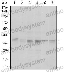 Anti-PPP1CA Antibody (R3P01)