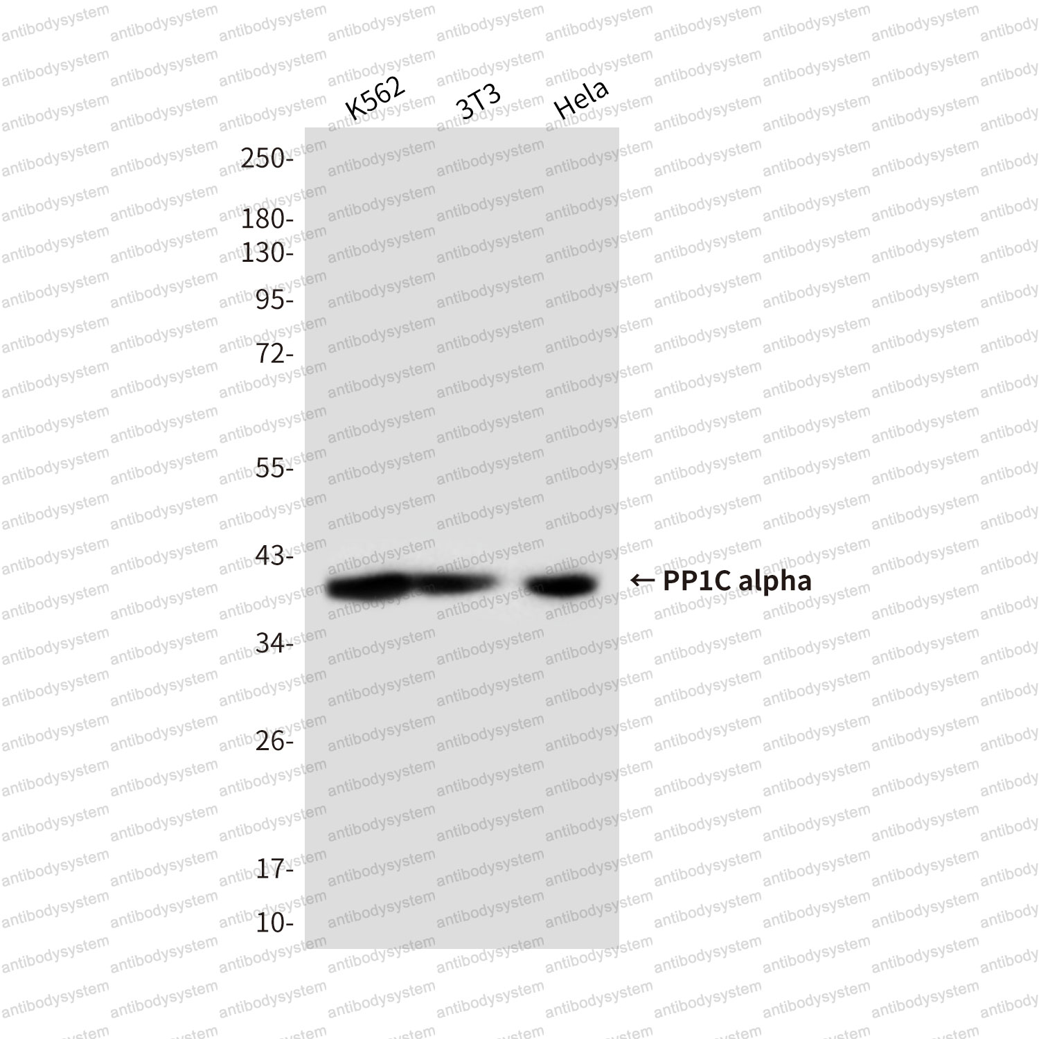 Anti-PPP1CA Antibody (R3P02)