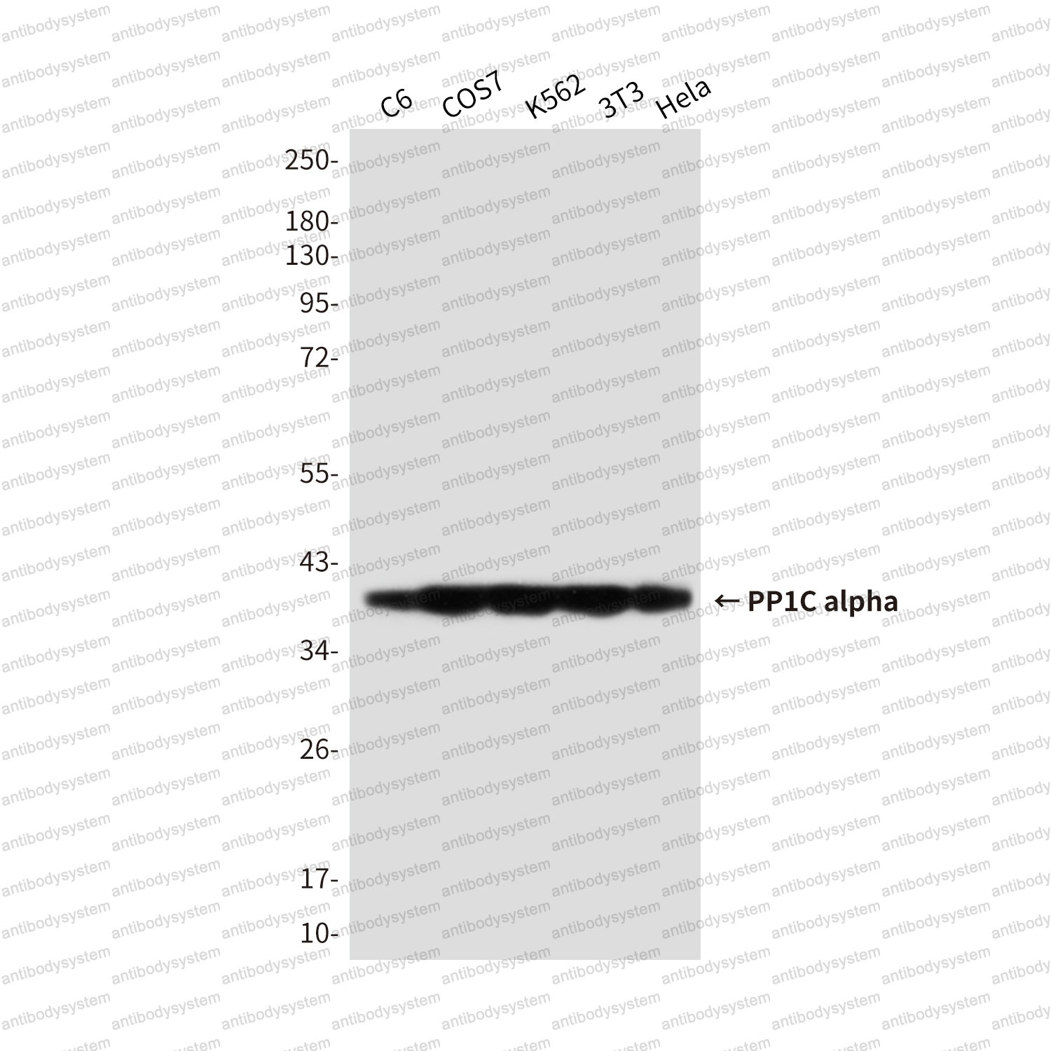 Anti-PPP1CA Antibody (R3P03)