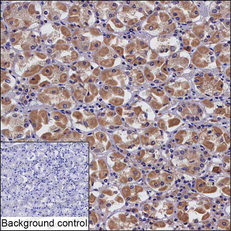 Anti-ARF6 Antibody (R3P06)