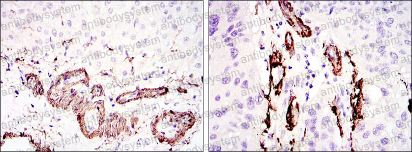 Anti-SMA/ACTA2 Antibody (R3P09)