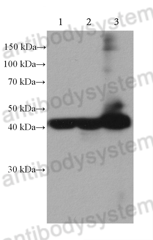Anti-SMA/ACTA2 Antibody (R3P08)
