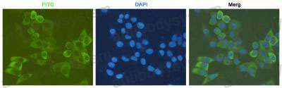 Anti-RPS6 Antibody (R3P16)