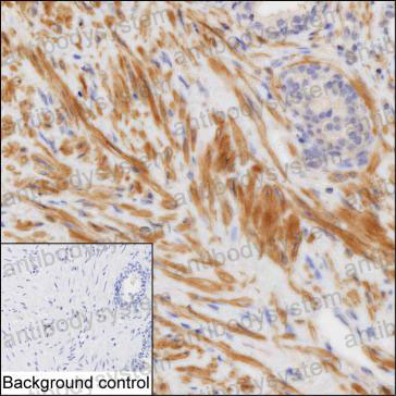Anti-ACTG2 Antibody (R3P33)