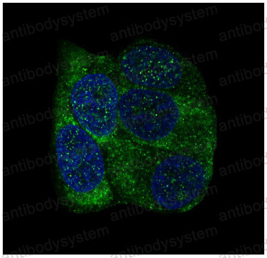 Anti-YBX1 Antibody (R1B96)