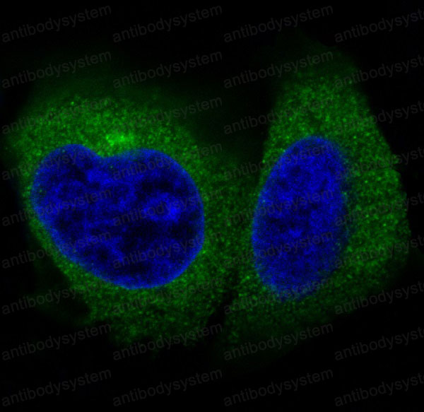 Anti-ACTA1/Alpha Actin Antibody (R1A01)