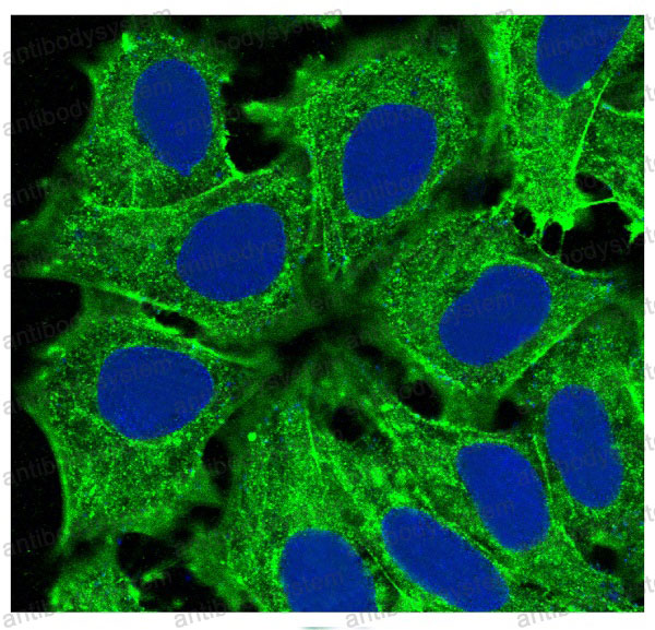 Anti-ACTA1/Alpha Actin Antibody (R1A71)