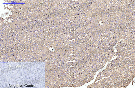Anti-ACTA1 Antibody (R3P37)