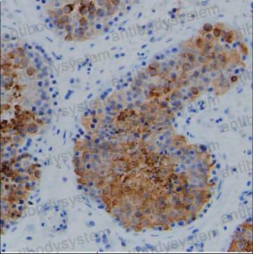 Anti-Alpha Tubulin Antibody (R3P39)