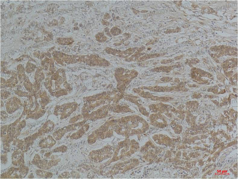 Anti-TUBA1B/Alpha Tubulin Antibody (R3P41)