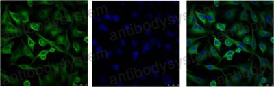 Anti-Alpha Tubulin Antibody (R3P43)