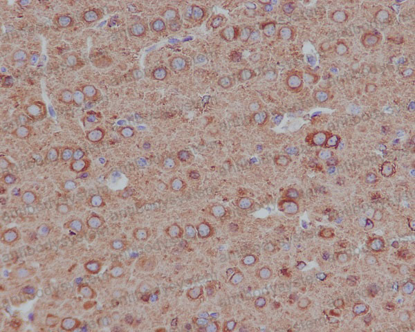 Anti-TUBB4B Antibody (R1B51)