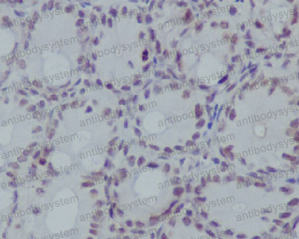 Anti-Histone H3 (monomethyl R17) Antibody (R1A93)