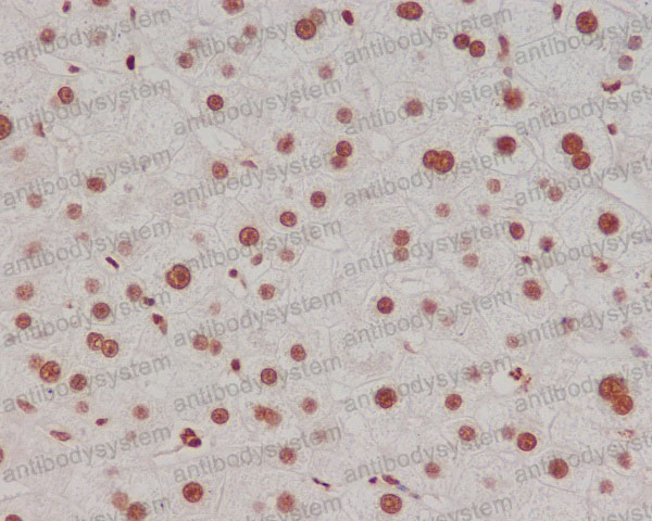 Anti-Methyl-Histone H3 (diK4) Antibody (R1A58)