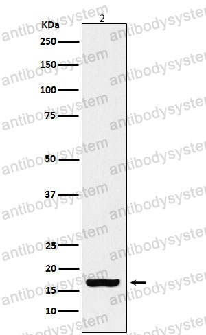 Anti-Histone H3 (acetyl K18) Antibody (R2B04)