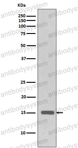 Anti-Histone H3 (trimethyl K27) Antibody (R2B05)