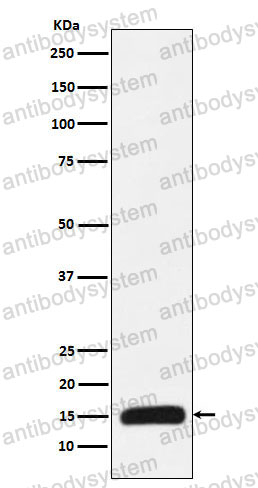 Anti-Histone H3 (mutated K27M) Antibody (R2B07)