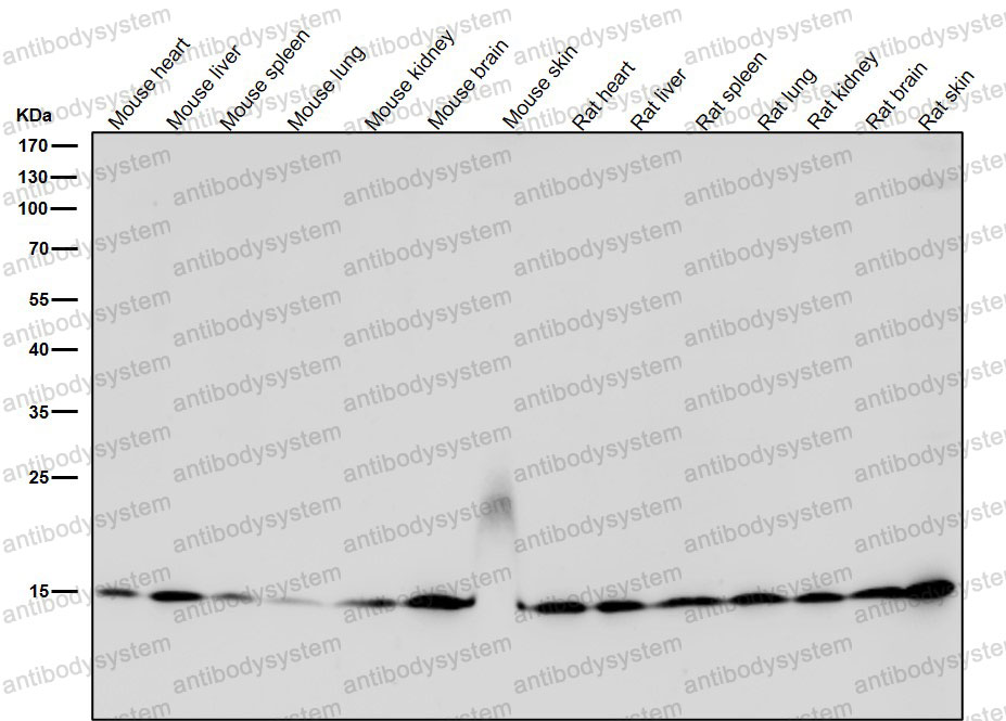 Anti-Histone H3 (acetyl K27) Antibody (R2B08)