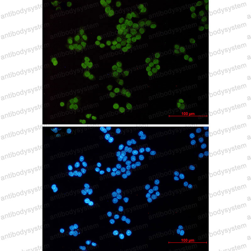 Anti-Acetyl-Histone H3 (Lys14) Antibody (R2B11)