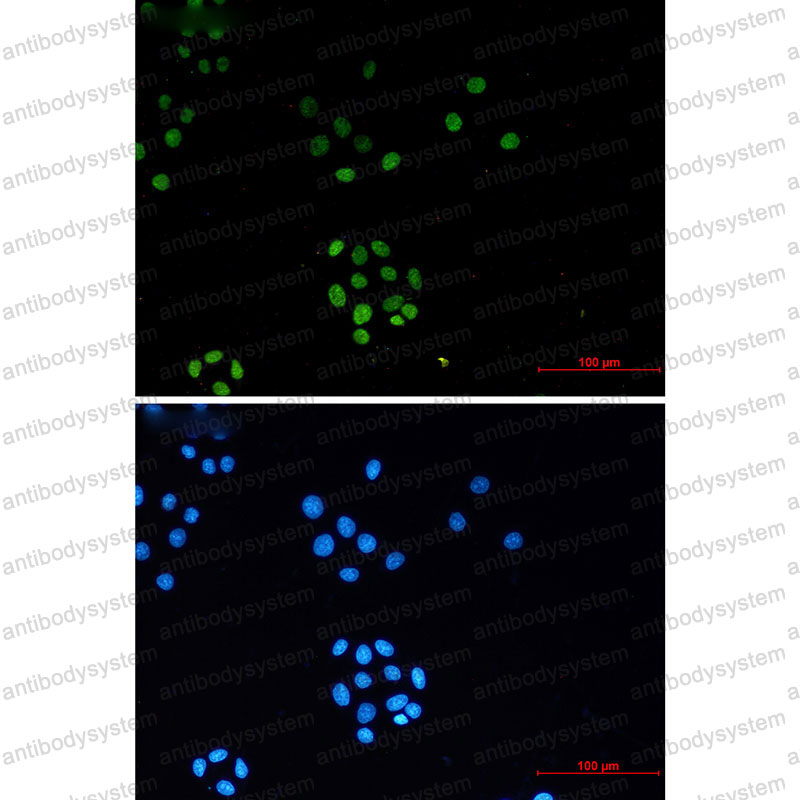 Anti-TriMethyl-Histone H3 (Lys27) Antibody (R2B13)