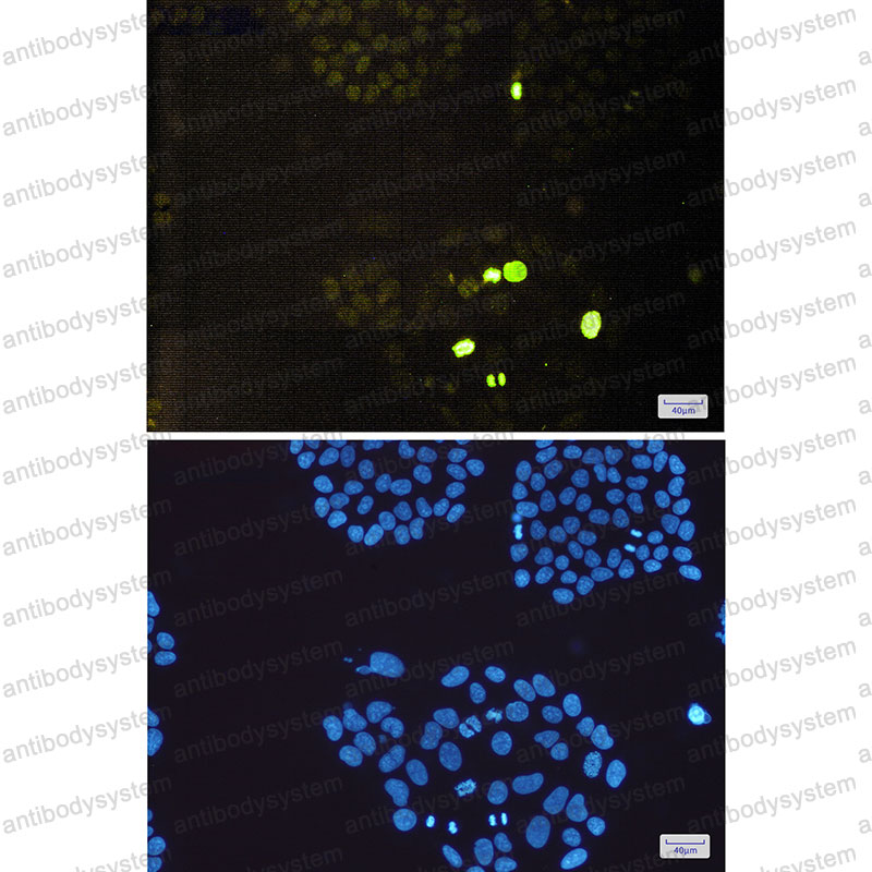Anti-Phospho-Histone H3 (Thr3) Antibody (R2B16)
