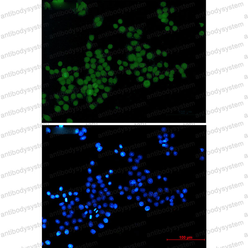 Anti-Phospho-Histone H3 (Ser10/Thr11) Antibody (R2B17)