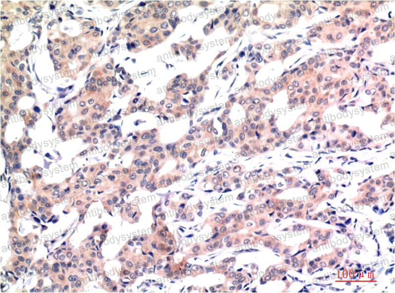 Anti-Acetyl-Histone H3 (Lys9) Antibody (R3P46)