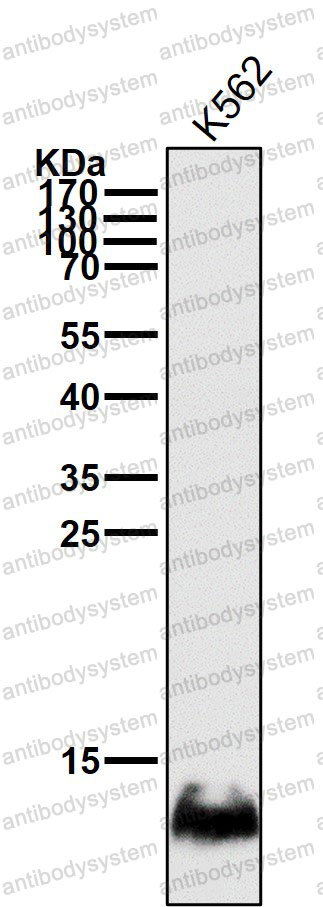 Anti-HBG1/2 Antibody (R2B19)