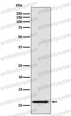 Anti-HBG1 Antibody (R2B20)