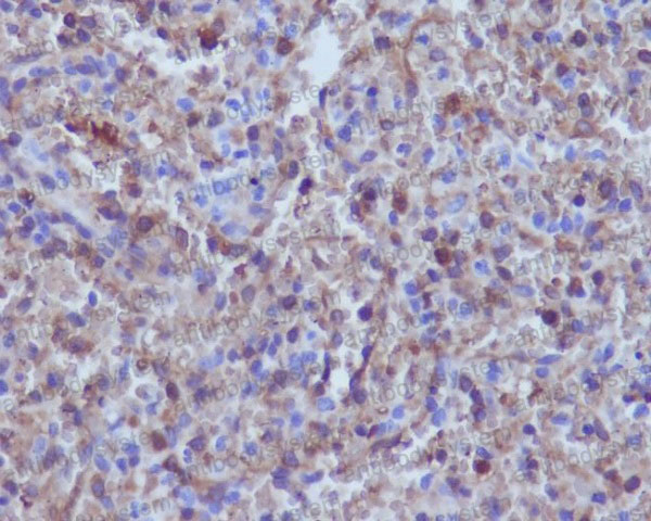Anti-HBA1/B Antibody (R2B21)