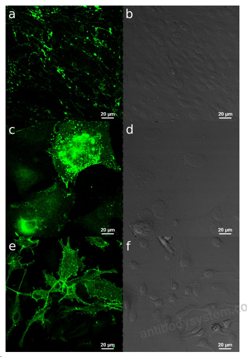 Immunofluorescence for Anti-Human CXADR Antibody (SAA0357) ?>