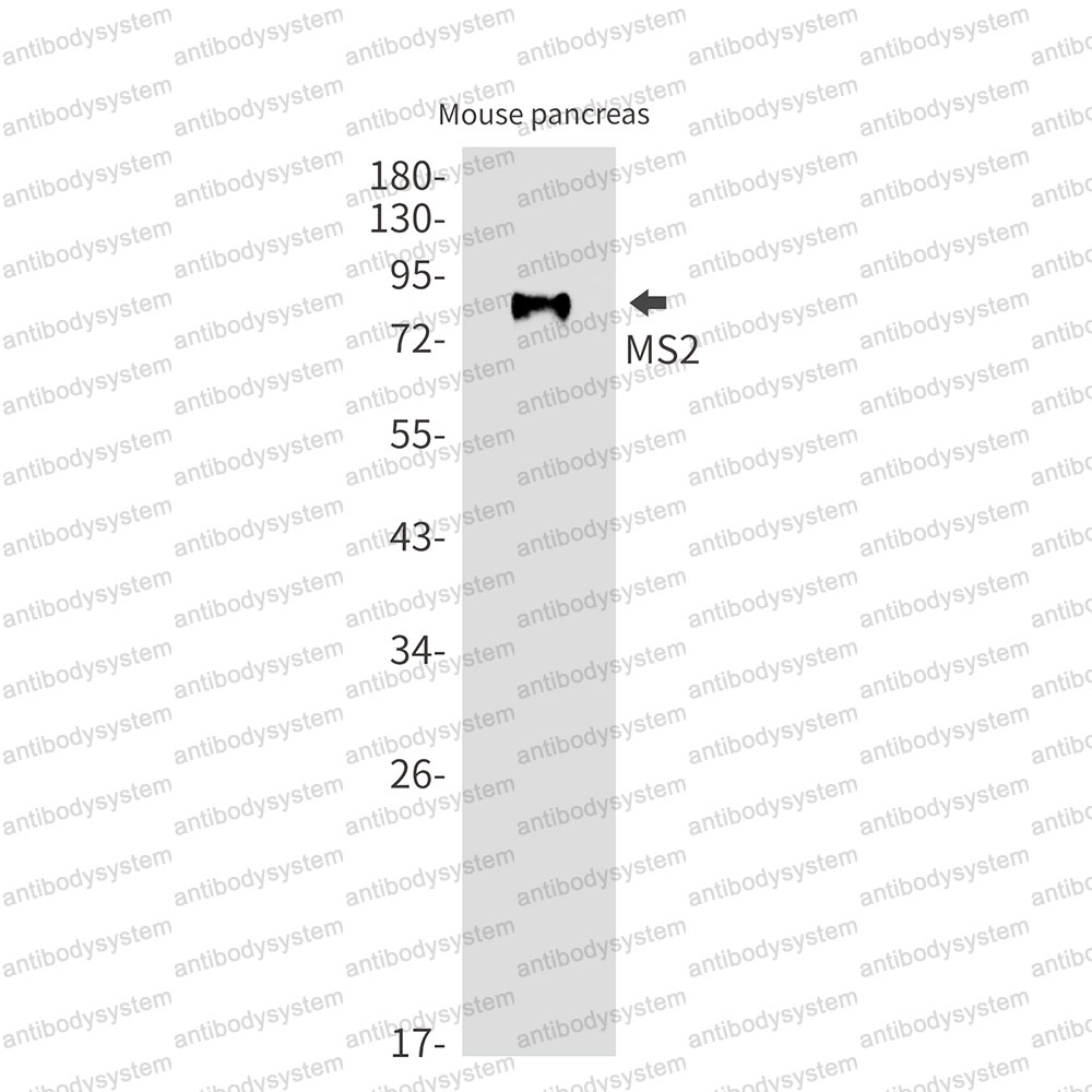 Anti-CD156a/ADAM8 Antibody (R2B24)