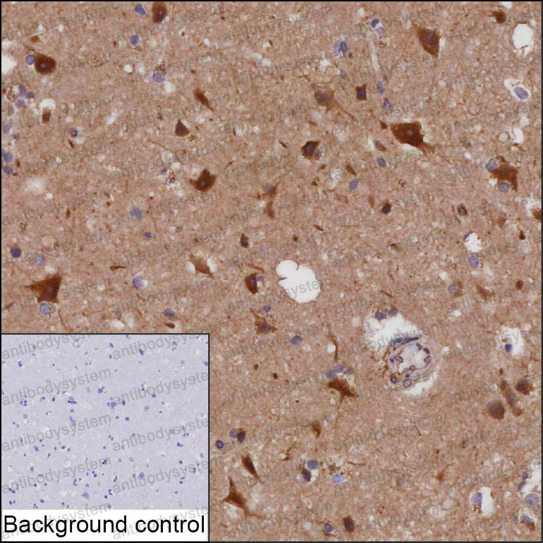 Anti-GPC5 Antibody (R3P66)