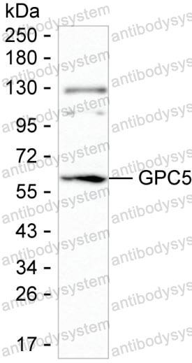Anti-GPC5 Antibody (R3P65)