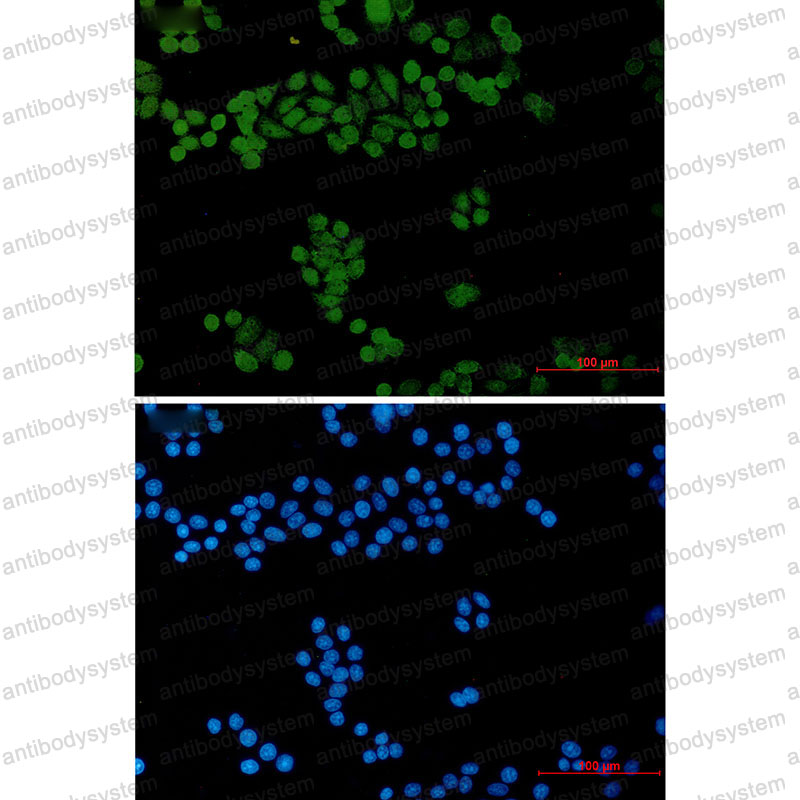 Anti-GTF2I Antibody (R2B26)