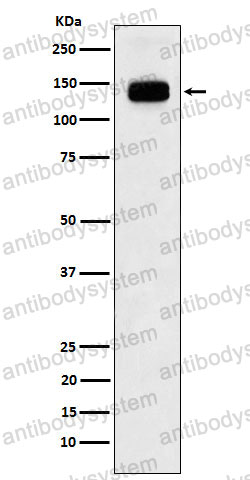 Anti-GTF2I Antibody (R2B25)