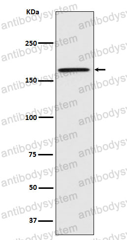 Anti-CNTNAP1 Antibody (R2B27)